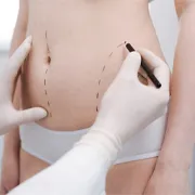手術動刀久恢復